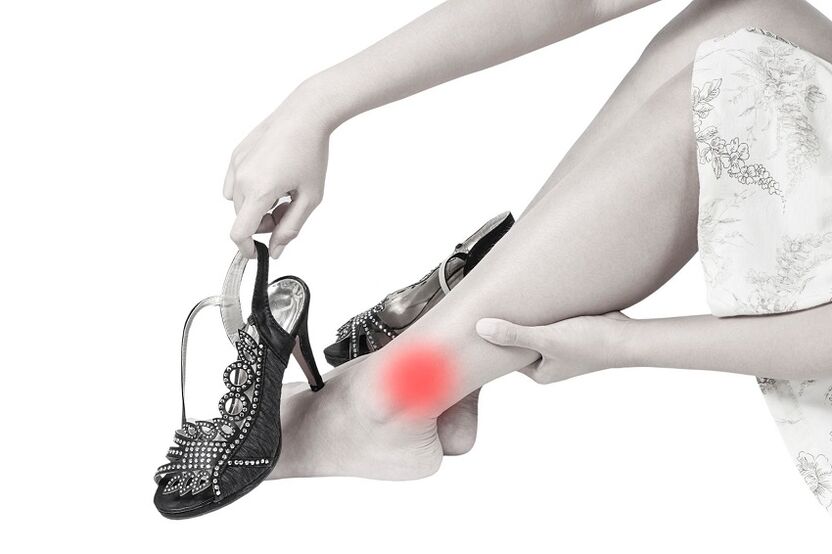 Dolore alla caviglia dovuto all'artrosi
